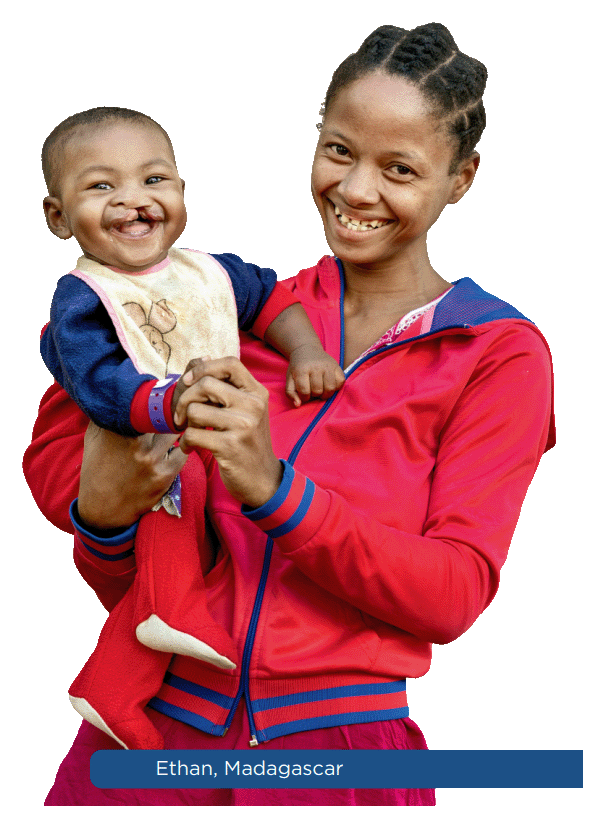 Mother and child supported by Operation Smile